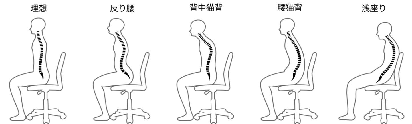 慢性腰痛の原因