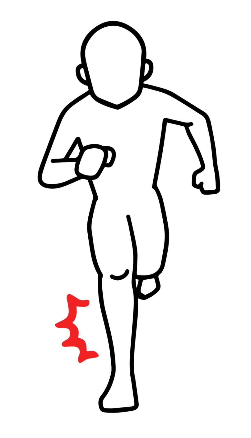 シンスプリントの原因