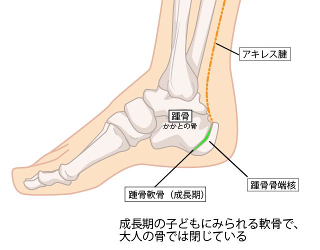 シーバー病が考えられる症状