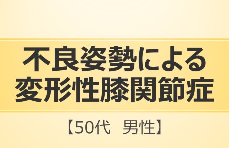 不良姿勢による変形性膝関節症の施術を受ける男性